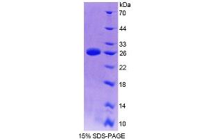 SDS-PAGE analysis of Mouse TMEM1 Protein. (TRAPPC10 Protéine)