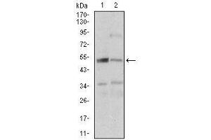 Western blot analysis using DAPK3 mouse mAb against A431 (1), K562 (2) cell lysate. (DAPK3 anticorps  (AA 28-161))