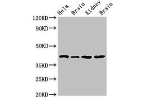 Western Blot Positive WB detected in: Hela whole cell lysate, Rat brain tissue, Mouse kidney tissue, Mouse brain tissue All lanes: ATAD1 antibody at 4 μg/mL Secondary Goat polyclonal to rabbit IgG at 1/50000 dilution Predicted band size: 41, 33 kDa Observed band size: 41 kDa (ATAD1 anticorps  (AA 289-350))