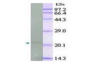 Image no. 1 for anti-Tumor Necrosis Factor alpha (TNF alpha) antibody (ABIN791557) (TNF alpha anticorps)