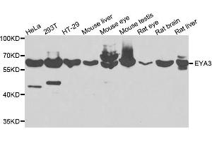 Western blot analysis of extracts of various cells, using EYA3 antibody. (EYA3 anticorps)