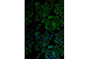 Immunofluorescence analysis of HeLa cell using TNFRSF1A antibody. (TNFRSF1A anticorps)