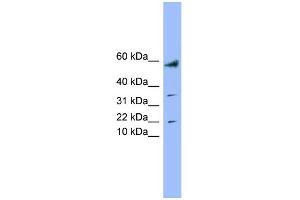 WB Suggested Anti-LYRM1 Antibody Titration: 0. (LYRM1 anticorps  (Middle Region))