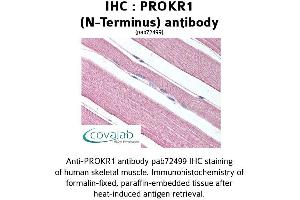 Image no. 1 for anti-Prokineticin Receptor 1 (PROKR1) (Extracellular Domain), (N-Term) antibody (ABIN1738398) (Prokineticin Receptor 1 anticorps  (Extracellular Domain, N-Term))