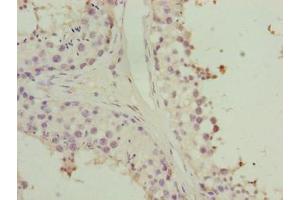 Immunohistochemistry of paraffin-embedded human testis tissue using ABIN7155901 at dilution of 1:100 (HORMAD2 anticorps  (AA 14-307))