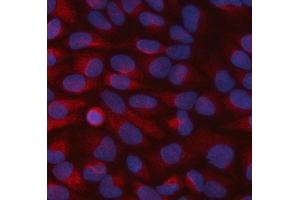 IF analysis of STBD1 using anti-STBD1 antibody (ABIN7601576).