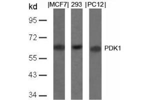 Image no. 4 for anti-3-phosphoinositide Dependent Protein Kinase-1 (PDPK1) (Ser241) antibody (ABIN197101) (PDPK1 anticorps  (Ser241))