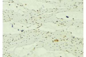 ABIN6277663 at 1/100 staining Mouse muscle tissue by IHC-P. (MAP1LC3A anticorps  (Internal Region))