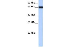 WB Suggested Anti-ZNF14 Antibody Titration:  0. (ZFP14 anticorps  (N-Term))