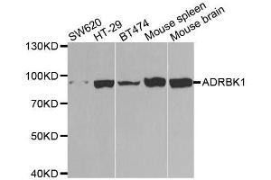 Western blot analysis of extracts of various cell lines, using ADRBK1 antibody.