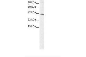 Image no. 2 for anti-Forkhead Box F2 (FOXF2) (AA 52-101) antibody (ABIN202540) (FOXF2 anticorps  (AA 52-101))