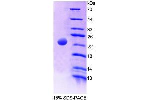 SDS-PAGE (SDS) image for Megakaryocyte-Associated tyrosine Kinase (MATK) (AA 1-173) protein (His tag) (ABIN4989434)
