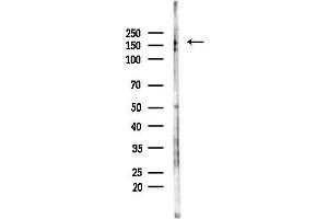 Western blot analysis of lysates from F10-LUC cells(LPS,4h treatment), using Phospho-HER2/Erb (Tyr877) Antibody at 1/1000 dilution.