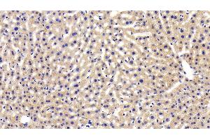 Detection of LEPR in Mouse Liver Tissue using Polyclonal Antibody to Leptin Receptor (LEPR)