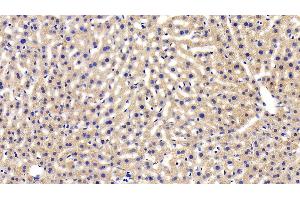 Detection of LEPR in Mouse Liver Tissue using Polyclonal Antibody to Leptin Receptor (LEPR) (Leptin Receptor anticorps  (AA 22-203))