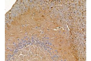 ABIN6265684 and ABIN6278747 at 1/100 staining rat brain tissue by IHC-P. (TPD52L1 anticorps  (N-Term))