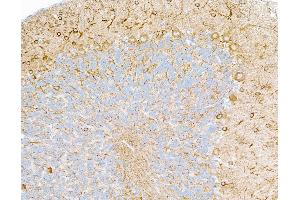 anti-Tubulin, beta 3 (TUBB3) (AA 400-450) antibody