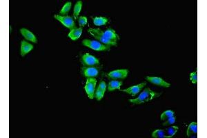 Immunofluorescent analysis of HepG2 cells using ABIN7143865 at dilution of 1:100 and Alexa Fluor 488-congugated AffiniPure Goat Anti-Rabbit IgG(H+L)