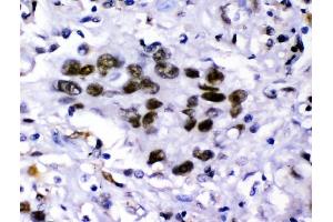 IHC analysis of KDM5B using anti-KDM5B antibody (ABIN4886648). (KDM5B anticorps  (Middle Region))