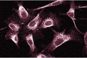 Immunofluorescent staining of Human Endothelial cells. (RAB5 anticorps  (AA 1-215))