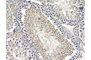 anti-Transmembrane Inner Ear (TMIE) antibody
