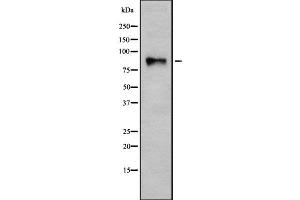 Western blot analysis ITGB7 using COLO205 whole cell lysates (Integrin beta 7 anticorps  (Internal Region))