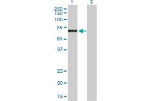 Western Blot analysis of ACD expression in transfected 293T cell line by ACD MaxPab polyclonal antibody.