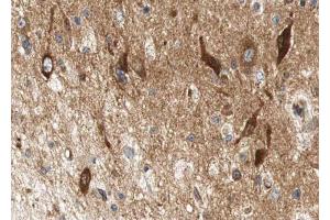 ABIN6267612 at 1/100 staining human brain tissue sections by IHC-P.