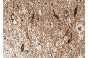 ABIN6267612 at 1/100 staining human brain tissue sections by IHC-P.