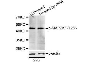 Western blot analysis of extracts of 293 cells, using Phospho-MAP2K1-T286 antibody (ABIN5995642) at 1/1000 dilution. (MEK1 anticorps  (pThr285))
