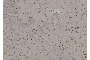 ABIN6273591 at 1/100 staining Rat brain tissue by IHC-P.