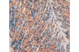 Used in DAB staining on fromalin fixed paraffin- embedded stomach tissue