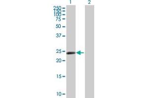 Western Blot analysis of ZNF501 expression in transfected 293T cell line by ZNF501 MaxPab polyclonal antibody. (ZNF501 anticorps  (AA 1-262))