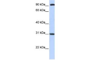Western Blotting (WB) image for anti-Ankyrin Repeat, Family A (RFXANK-Like), 2 (ANKRA2) antibody (ABIN2459440) (ANKRA2 anticorps)
