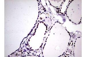 Image no. 2 for anti-Nibrin (NBN) (AA 183-460) antibody (ABIN1491058)