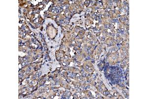 IHC analysis of PAK3 using anti-PAK3 antibody (ABIN7599182).