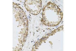 Immunohistochemistry of paraffin-embedded human prostate using POP4 antibody (ABIN6128482, ABIN6145964, ABIN6145966 and ABIN6220640) at dilution of 1:100 (40x lens). (RPP29 anticorps  (AA 1-220))