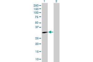 Western Blot analysis of EPHA10 expression in transfected 293T cell line by EPHA10 MaxPab polyclonal antibody. (EPH Receptor A10 anticorps  (AA 1-295))