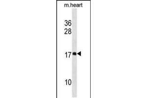 Western blot analysis in mouse heart tissue lysates (35ug/lane). (DAPL1 anticorps  (N-Term))