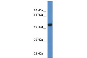 WB Suggested Anti-Pcyt2 Antibody Titration: 1. (PCYT2 anticorps  (N-Term))