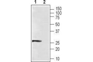 Western blot analysis of rat eye lysate: - 1. (CABP4 anticorps  (Intracellular))