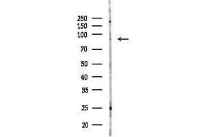 anti-Mitogen-Activated Protein Kinase Kinase Kinase 12 (MAP3K12) (N-Term) antibody