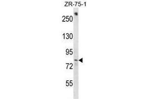 BACH1 Antibody (C-term) western blot analysis in ZR-75-1 cell line lysates (35µg/lane). (BACH1 anticorps  (C-Term))