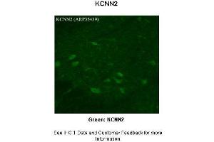 Sample Type :  Rhesus macaque spinal cord  Primary Antibody Dilution :  1:300  Secondary Antibody :  Donkey anti Rabbit 488  Secondary Antibody Dilution :  1:500  Color/Signal Descriptions :  Green: KCNN2  Gene Name :  KCNN2  Submitted by :  Timur Mavlyutov, Ph. (KCNN2 anticorps  (Middle Region))