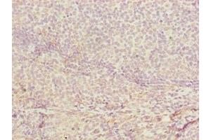 Immunohistochemistry of paraffin-embedded human tonsil tissue using ABIN7149078 at dilution of 1:100 (CDADC1 anticorps  (AA 1-99))