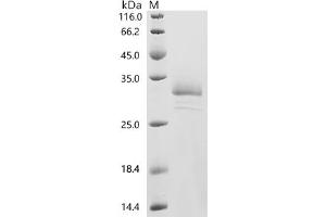 (Tris-Glycine gel) Discontinuous SDS-PAGE (reduced) with 5 % enrichment gel and 15 % separation gel.