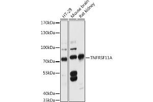 Western blot analysis of extracts of various cell lines, using TNFRSF11A antibody (ABIN6127588, ABIN6149309, ABIN6149311 and ABIN6216817) at 1:3000 dilution.