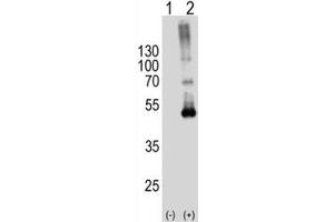 Western blot analysis of SPHK1 antibody and 293T cell lysate either nontransfected (Lane 1) or transiently transfected (2) with the SPHK1 gene. (SPHK1 anticorps  (AA 1-30))