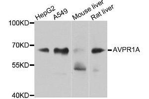 Western blot analysis of extracts of various cells, using AVPR1A antibody. (AVPR1A anticorps)