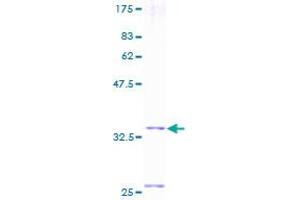Image no. 1 for Matrix Gla Protein (MGP) (AA 1-103) protein (GST tag) (ABIN1310886)